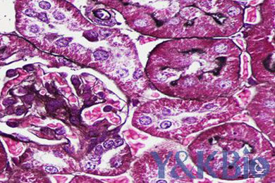 云南六胺银染色