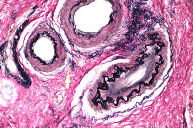 云南弹力纤维染色