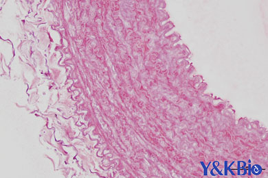 云南茜素红染色