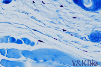 云南甲苯胺蓝染色