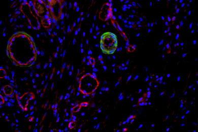 云南免疫荧光双标