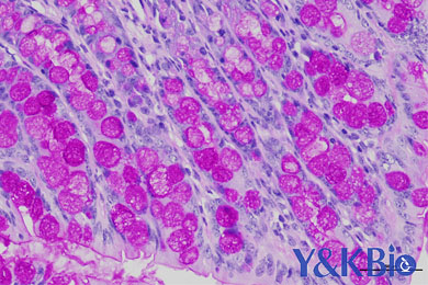 云南糖原PAS染色