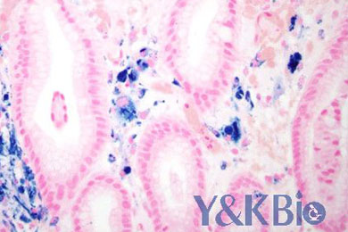 云南普鲁士蓝染色