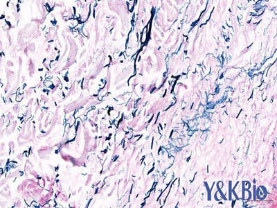 云南维多利亚蓝染色