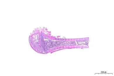 云南脱钙（慢脱）