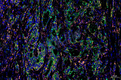 云南普通切片免疫荧光三标（四色）染色