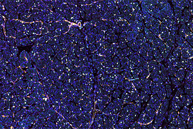 云南普通切片免疫荧光四标（五色）染色