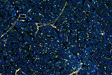 云南普通切片免疫荧光五标（六色）染色