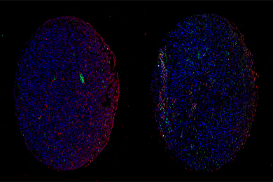 云南组织芯片免疫荧光单标（双色）染色