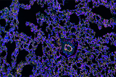 云南组织芯片免疫荧光双标（三色）染色
