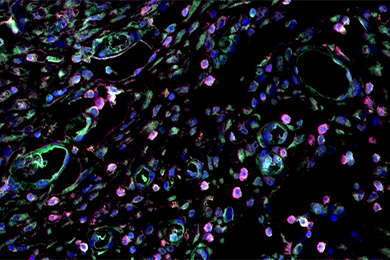 云南普通切片（荧光三标 四色）扫描