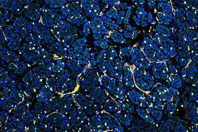 云南普通切片（荧光四标 五色）扫描