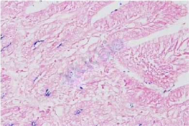 云南革兰氏染色