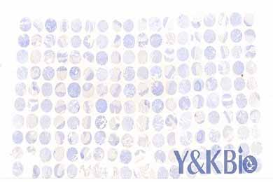 云南白光芯片扫描