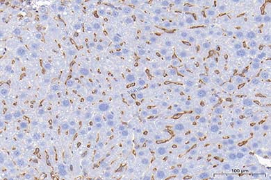 云南Anti-CD68 Antibody [PSH05-47]