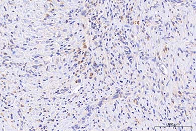 云南Anti-iNOS Antibody