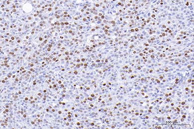 云南Anti-Ki67 Antibody [SR00-02]