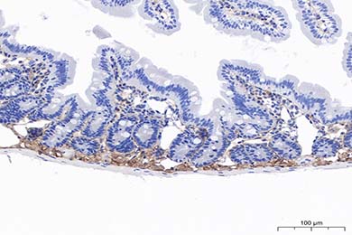 云南Anti-MMP-2 Antibody [PSH11-26]