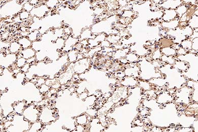 云南NF-kB p65 Recombinant Rabbit Monoclonal Antibody [SZ10-04]