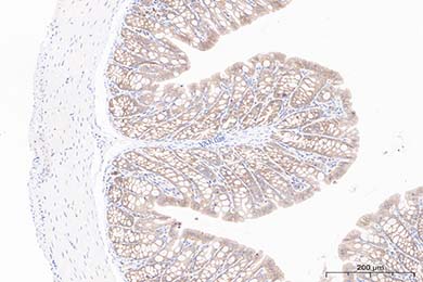 云南Occludin Recombinant Rabbit Monoclonal Antibody [JJ091-08]