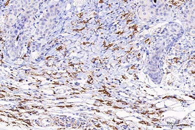 云南Mannose Receptor(CD206) Recombinant Rabbit Monoclonal Antibody [PSH07-76]
