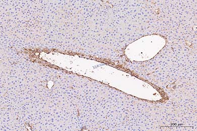 云南Anti-alpha smooth muscle Actin Antibody [SY02-64]
